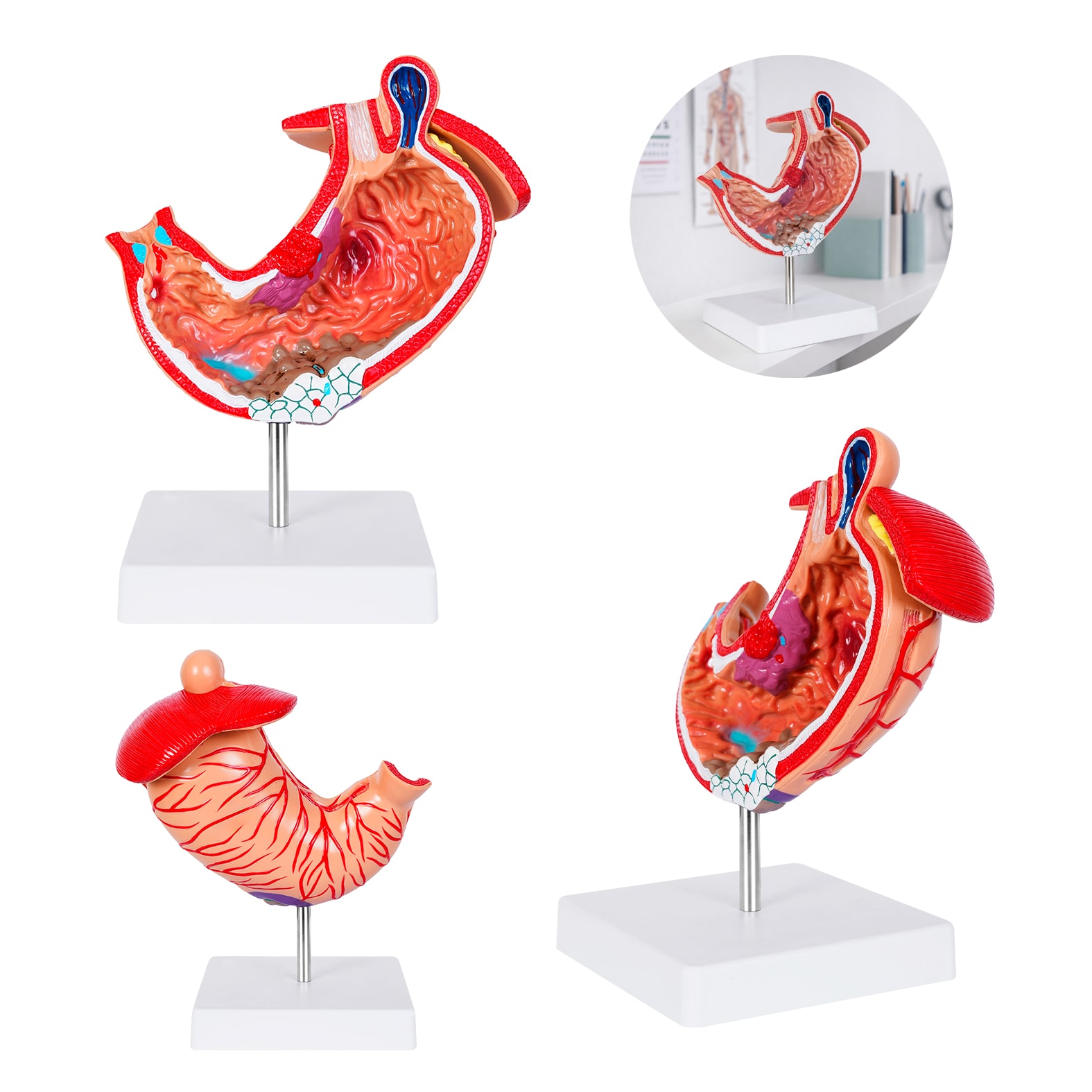 Modelo Anatómico Gastro, artículo promocional personalizable
